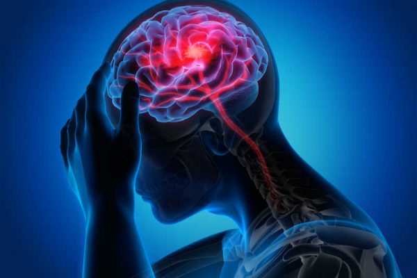 عوارض سکته مغزی چیست؟