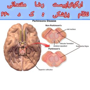 بهترین مرکز درمان پارکینسون