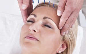 فیزیوتراپی صورت در سیدخندان