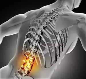 فیزیوتراپی سیاتیک در سیدخندان